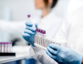 TARIFE ANALIZE MEDICALE HEMATOLOGIE BIOCHIMIE TARIFE ANALIZE MEDICALE HEMATOLOGIE BIOCHIMIE