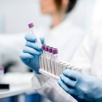 TARIFE  ANALIZE MEDICALE HEMATOLOGIE BIOCHIMIE