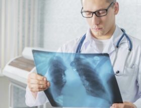TARIF RADIOLOGIE TARIF RADIOLOGIE