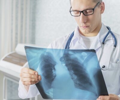 TARIF RADIOLOGIE